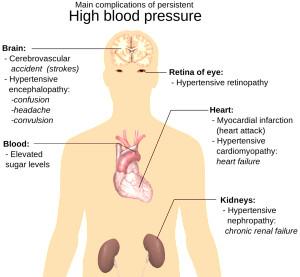 the-human-body-1279987_1280-300×277