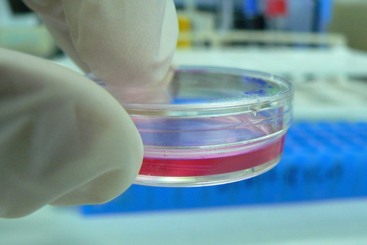 In vitro testing involves testing by using human cells in a petri dish.
