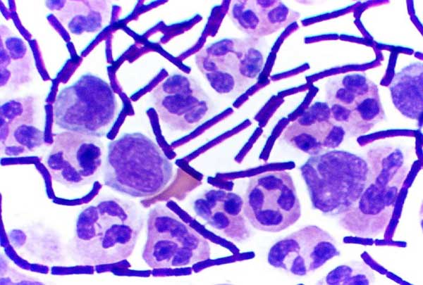 Gram_Stain_Anthrax