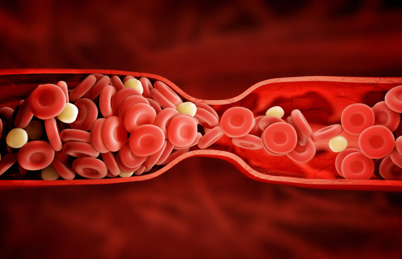 blood-clot-e1463494175829